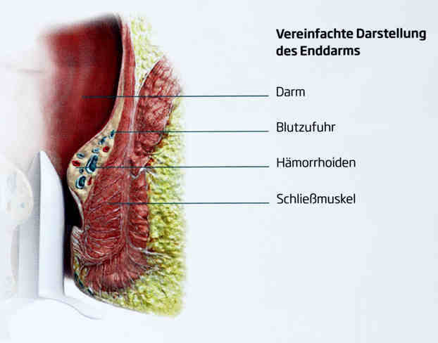Anatomy of rectum and hemorrhoids