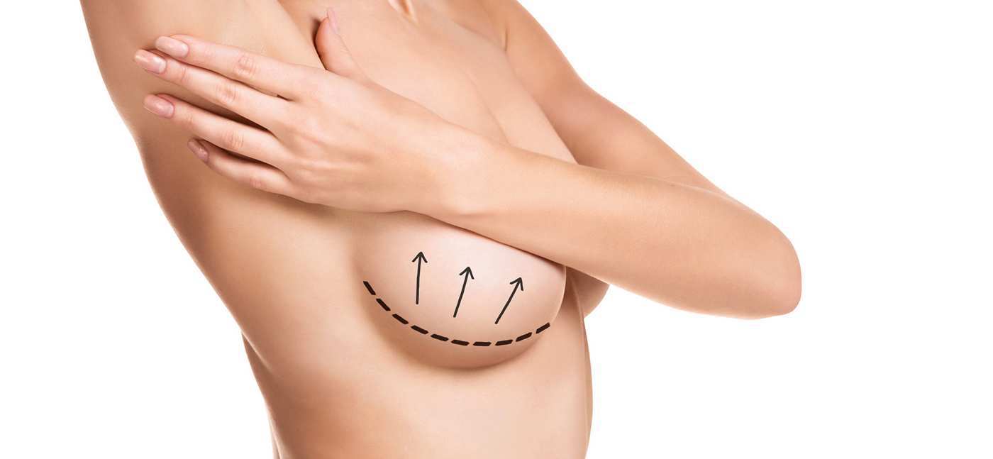 Brustvergrößerung-Bruststraffung innere Bh Methode Köln