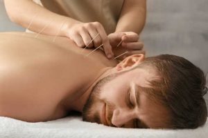 Akupunktur Schmerztherapie, Reflextherapie, Chiropraktik Köln