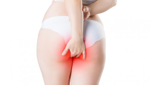 Proktologie Köln, Hämorrhoiden, anal, Schmerzen, Blutung, Jucken, Brennen, Fisteln, Marisken, Warzen, Riss,